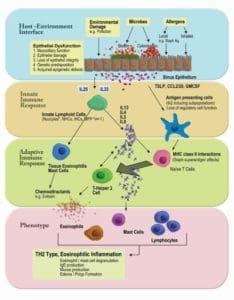 severe asthma and sinusitis