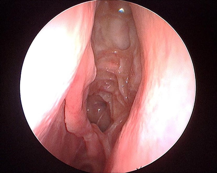 Safe and Practical Sinus Surgery