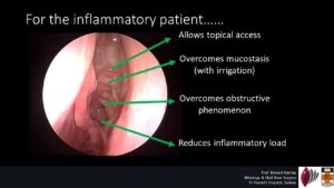 nasal-polyps-sydney-richard-harvey