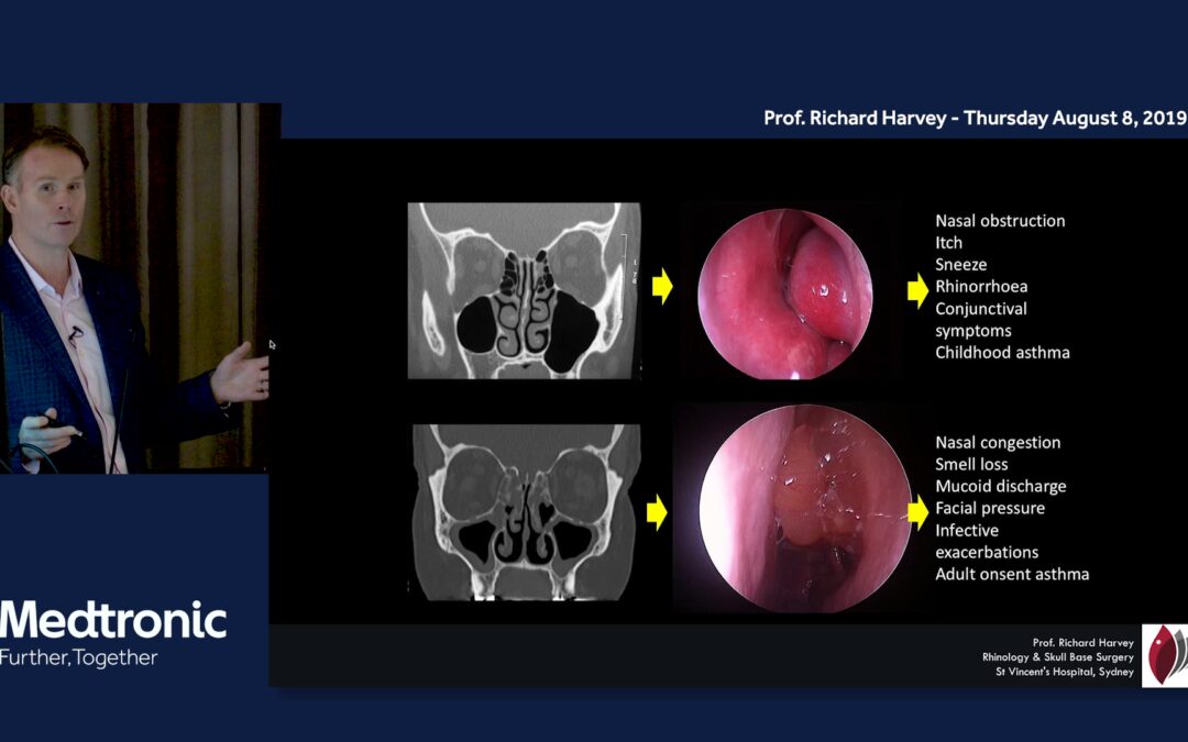 The basics of sinus & nasal anatomy and function