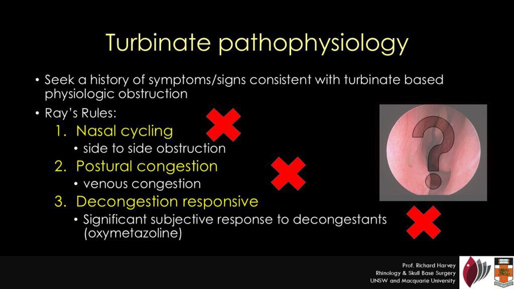Ray's rules turbinate reduction