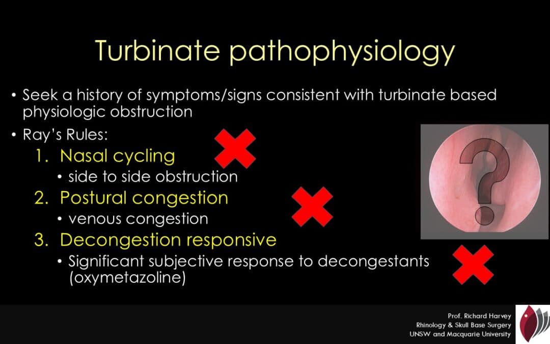 Ray's rules turbinate reduction